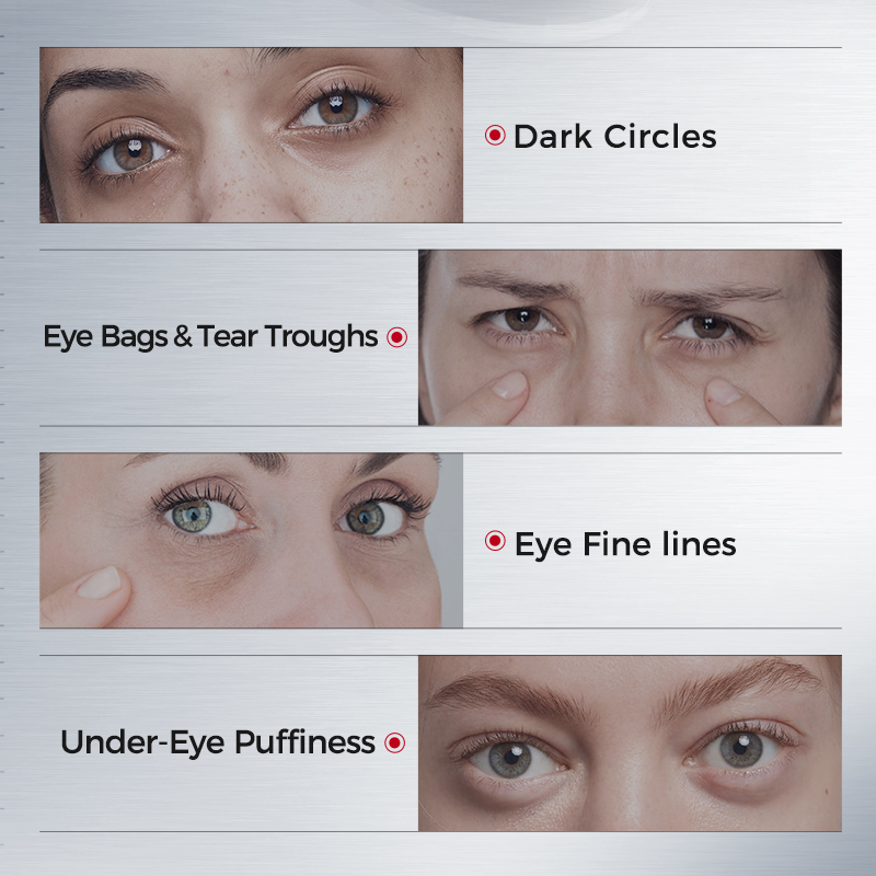 Патчи для глаз от темных круго – обзор и цена Collagen Under Eye Patches