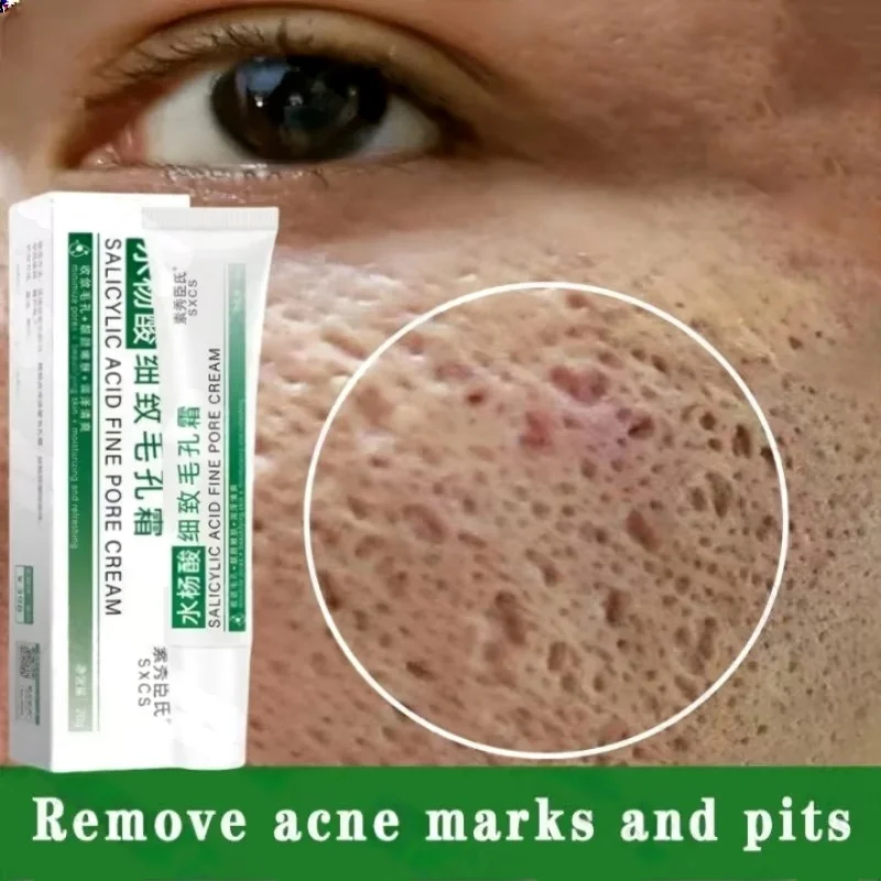Крем для очищения пор с салици – обзор и цена Salicylic Acid Blackhead Remover