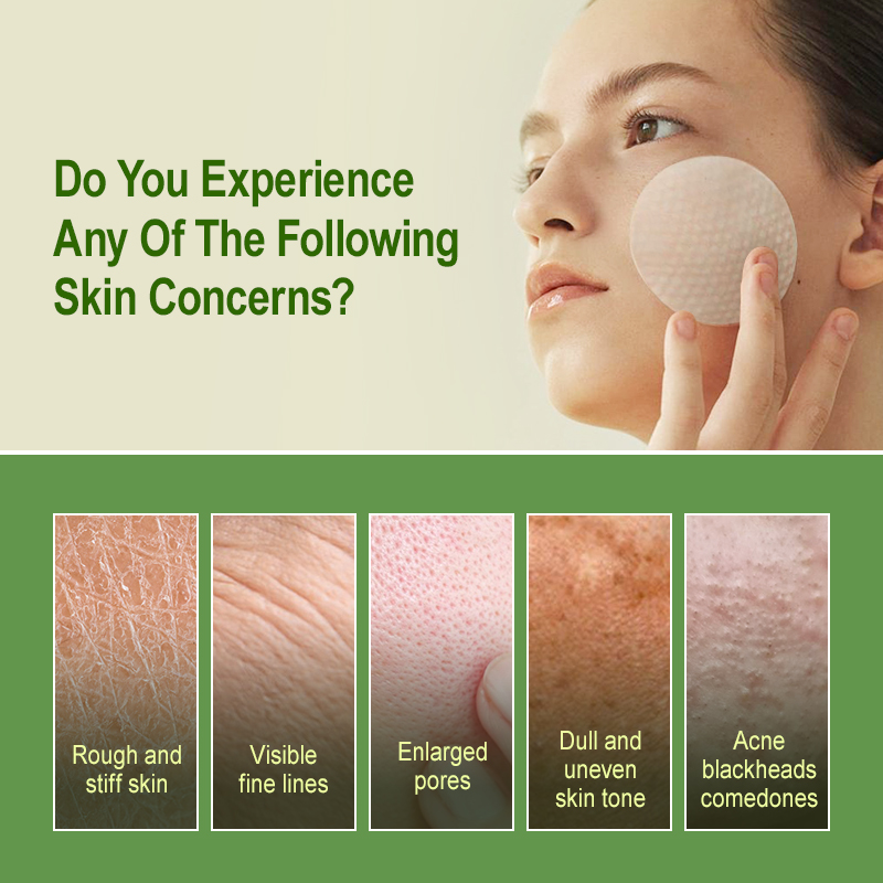 Отшелушивающие подушечки с сал – обзор и цена Salicylic Acid Blackhead Remover