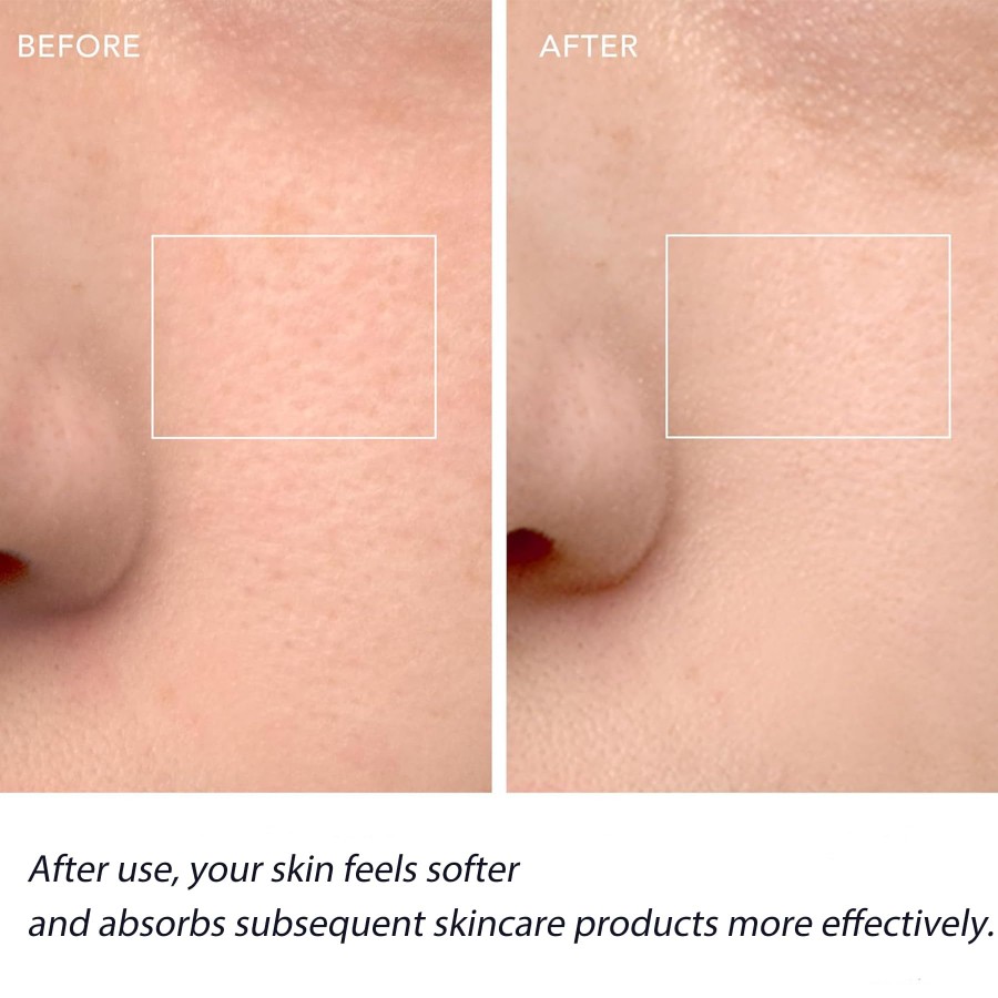 Щетка для очищения лица, перез – обзор и цена Silicone Face Scrubber Electric