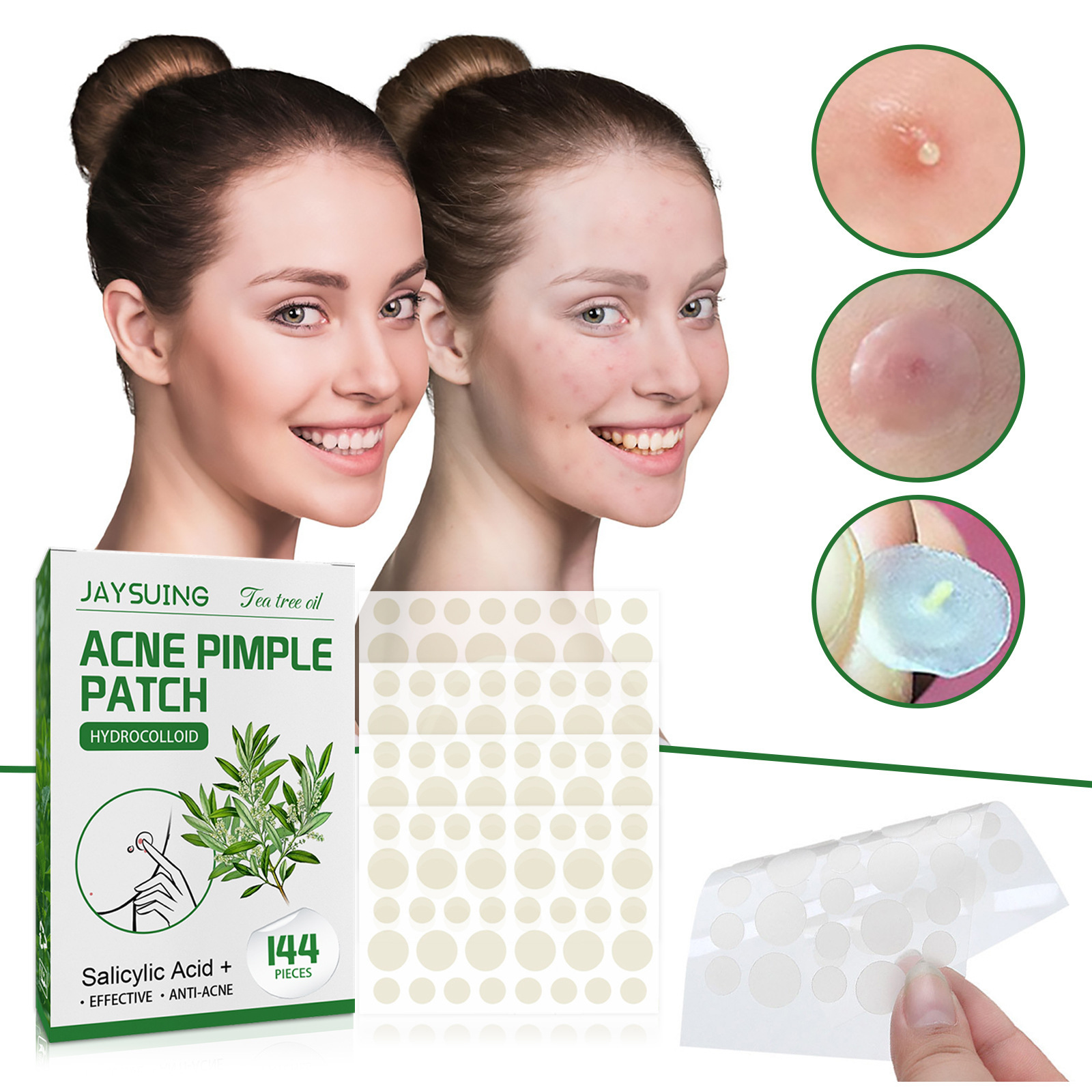 Гидроколлоидные пластыри от пр – обзор и цена Hydrocolloid Pimple Patch