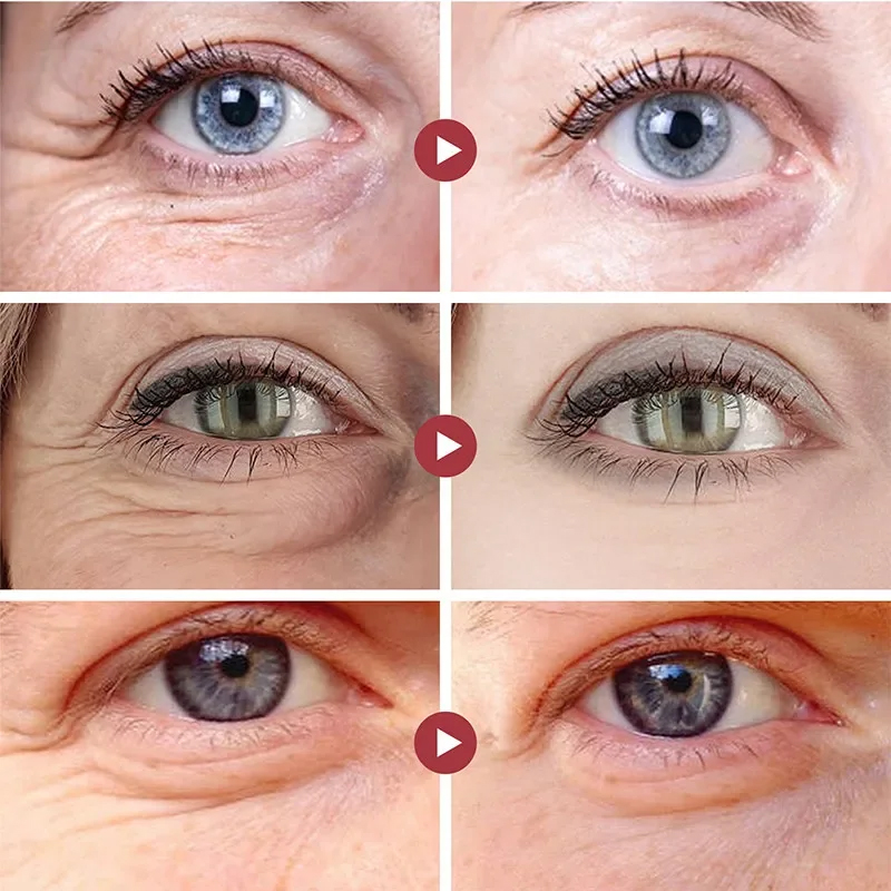 Удаление морщин, патчи для гла – обзор и цена Collagen Under Eye Patches