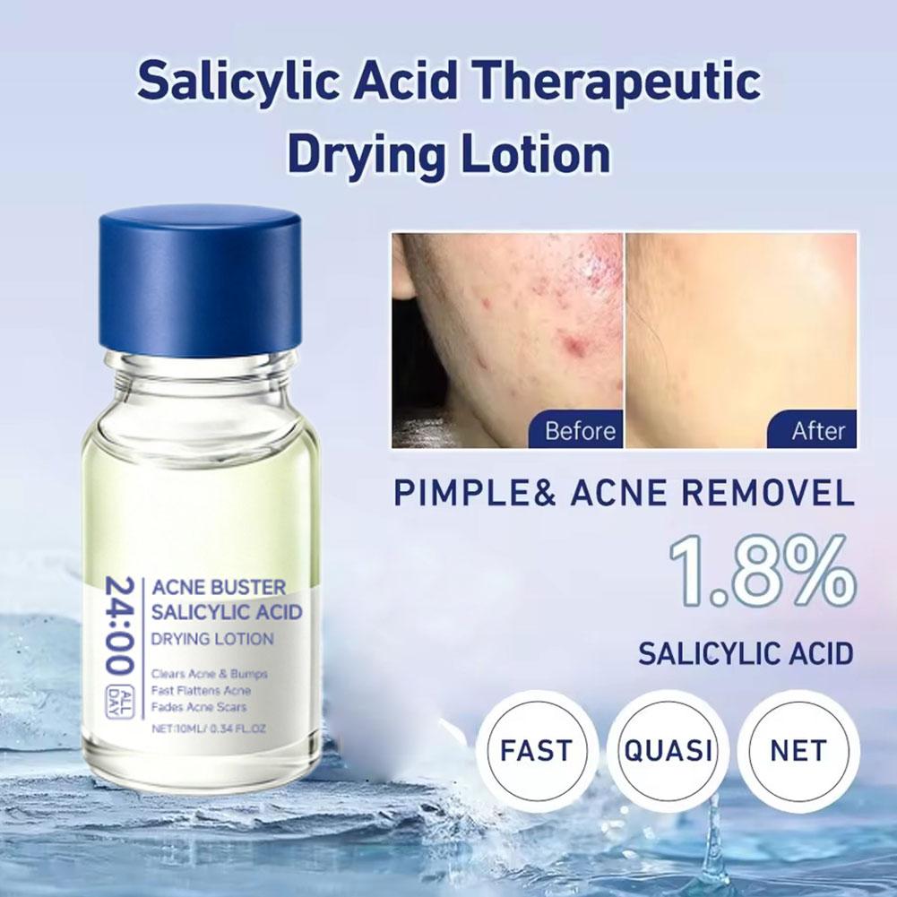 Салициловая кислота для устран – обзор и цена Salicylic Acid Blackhead Remover